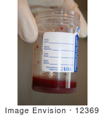 #12369 Stock Photo Of A Container Of Blood