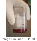 #12370 Stock Photography Of Blood In A Container