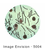 #5004 Stock Photography Of Anthrax Taken From A Peritoneum Using A Hiss Capsule Stain