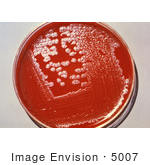 #5007 Stock Photography Of Agar Culture Plate Growing Anthrax Colonies