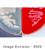 #5009 Stock Photography of Bicarbonate Agar and Blood Agar Plate Cultures of Anthrax by JVPD