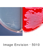 #5010 Stock Photography Of Anthrax Positive Encapsulation