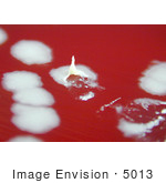 #5013 Stock Photography Of Anthrax Positive On Sheep Blood Agar