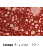 #5014 Stock Photography Of Anthrax Growing On An Agar Culture Plate With Blood