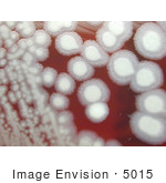 #5015 Stock Photography Of An Anthrax Colony