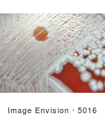 #5016 Stock Photography of Anthrax Gamma Phage Lysis On Sheep Blood Agar by JVPD