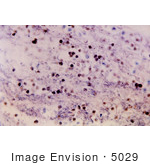 #5029 Stock Photography Of Anthrax Bacteria Closeup