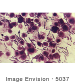 #5037 Micrograph Of Anthrax