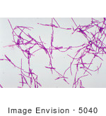 #5040 Stock Photography Of A Bacillus Anthracis Gram Stain