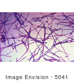 #5041 Stock Photography Of Anthrax Bacteria Displayed During A Gram Stain Technique