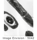 #5042 Stock Photography Of An Anthrax Transmission Electron Micrograph