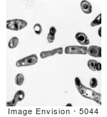 #5044 Bacillus Anthracis (Anthrax) Micrograph