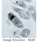 #5045 Anthrax Transmission Electron Micrograph