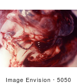 #5050 Stock Photography Of Chimpanzee Lungs Infected With Anthrax Disease