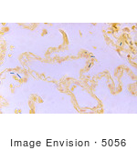 #5056 Stock Photography Of Bacillus Anthracis In A Lung