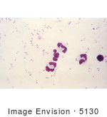 #5130 Micrograph Picture Of Plasmodium Falciparum Parasites In The Form Of Numerous Rings
