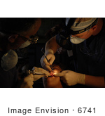 #6741 Performing A Tooth Extraction