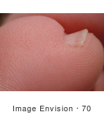 #70 Picture Of A Pinky Toe And Nail