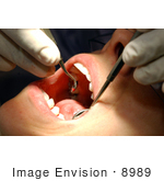 #8989 Picture Of A Dental Exam