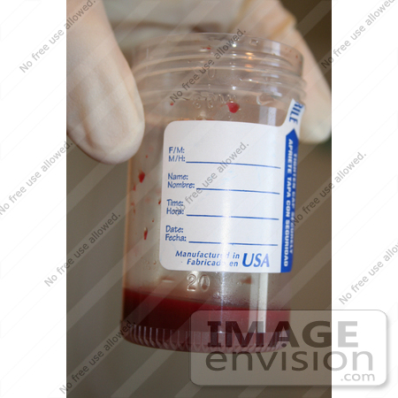 #12369 Stock Photo of a Container of Blood by Kenny Adams