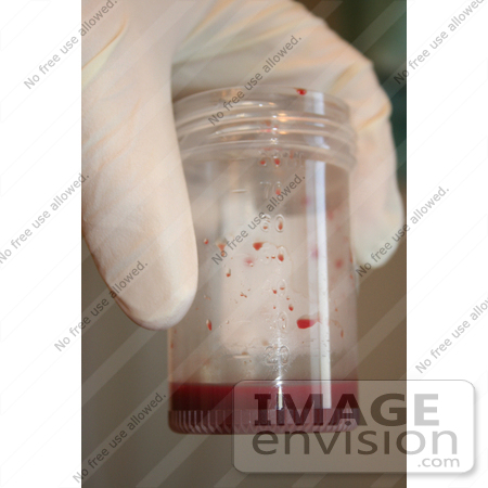 #12370 Stock Photography of Blood in a Container by Kenny Adams