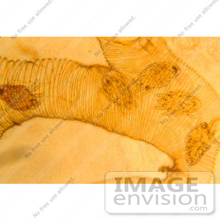 #25802 Stock Photography of a Micrograph of Mites Infesting a Bee Trachea by JVPD