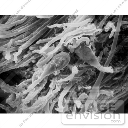 #26737 Stock Photography of a Scanning Electron Micrograph of Fergusonina Fly Eggs and Associated Juvenile Fergusobia Nematodes in a Melaleuca Flower Bud by JVPD