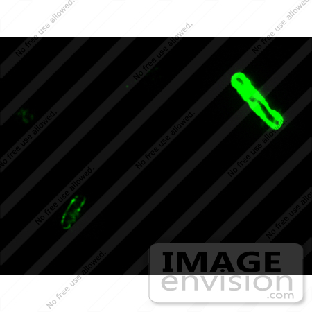 #4998 Stock Photography of Anthrax at 1000x Magnification by JVPD