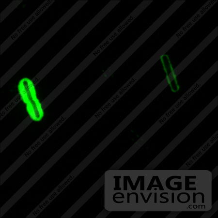 #5001 Stock Photography of Anthracis Direct Fluorescent Antibody (DFA) Capsule Stain by JVPD