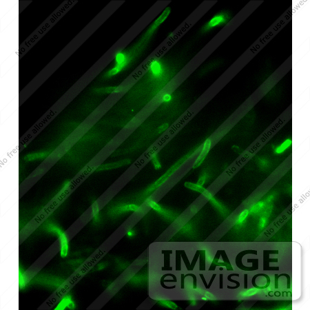 #5002 Stock Photography of Anthrax Direct Fluorescent Antibody (DFA) Cell Wall Stain by JVPD