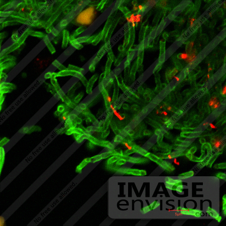 #5003 Stock Photography of Green Anthrax Cell Walls and Red Anthrax Spores. by JVPD