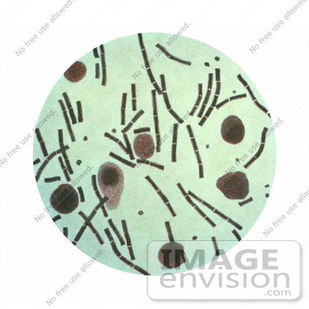 #5004 Stock Photography of Anthrax Taken from a Peritoneum Using a Hiss Capsule Stain by JVPD
