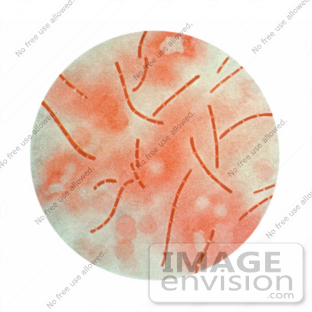 #5006 Stock Photography of Anthrax Bacteria Taken From Heart Blood by JVPD