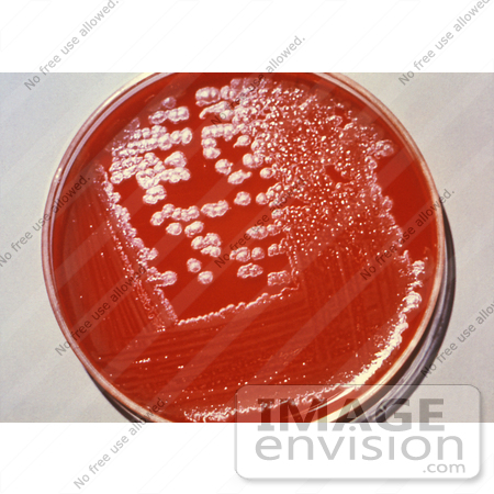 #5007 Stock Photography of Agar Culture Plate Growing Anthrax Colonies by JVPD