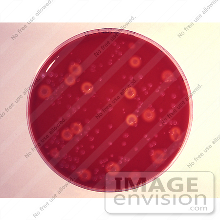 #5008 Stock Photography of a Blood Agar Culture Plate Growing Bacillus Anthracis (Anthrax) by JVPD