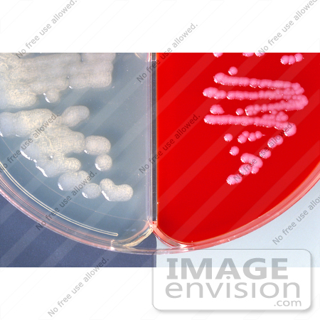 #5009 Stock Photography of Bicarbonate Agar and Blood Agar Plate Cultures of Anthrax by JVPD