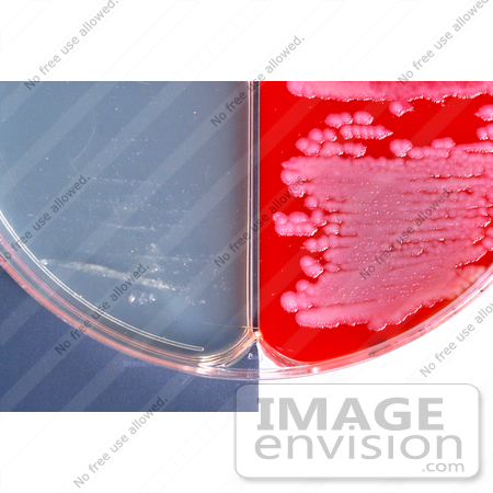 #5010 Stock Photography of Anthrax Positive Encapsulation by JVPD