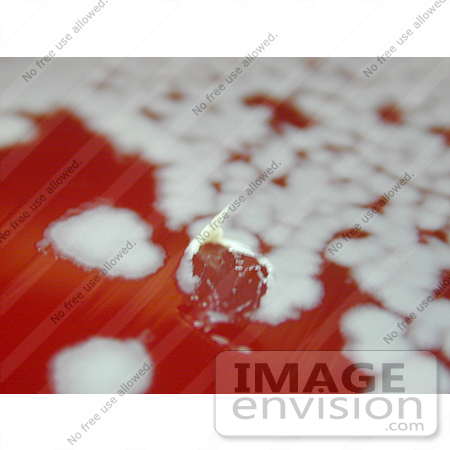 #5012 Stock Photography of Bacillus Anthracis Tenacity Positive On Sheep Blood Agar by JVPD