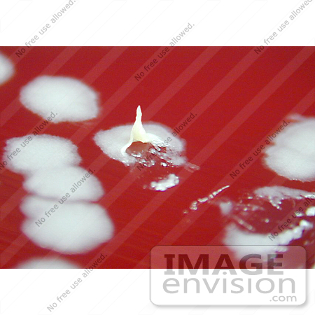#5013 Stock Photography of Anthrax Positive On Sheep Blood Agar by JVPD