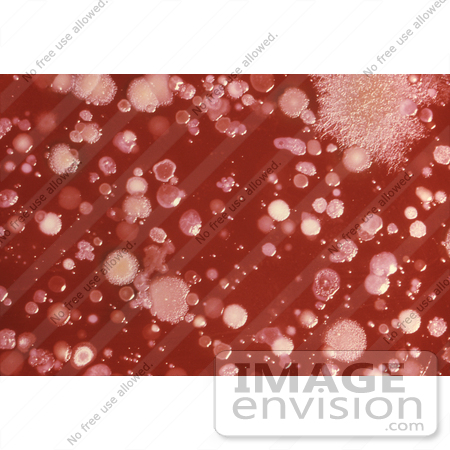 #5014 Stock Photography of Anthrax Growing On an Agar Culture Plate with Blood by JVPD
