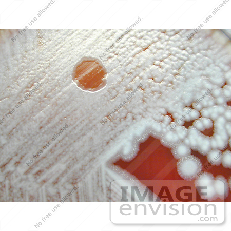 #5016 Stock Photography of Anthrax Gamma Phage Lysis On Sheep Blood Agar by JVPD