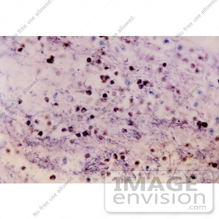 #5029 Stock Photography of Anthrax Bacteria Closeup by JVPD