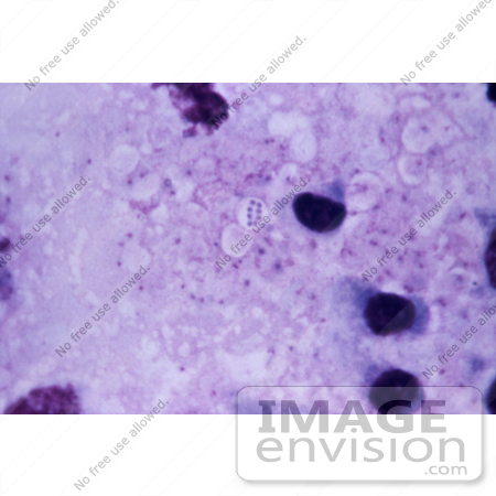 #5031 Stock Photography of Mediastinal Lymph Node from a Cynomolgus Monkey Infected with Anthrax. by JVPD