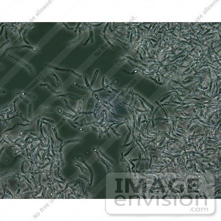 #5036 Stock Photography - Bacillus Anthracis Spores Microscopy by JVPD