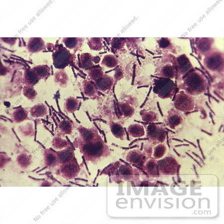 #5037 Micrograph of Anthrax by JVPD
