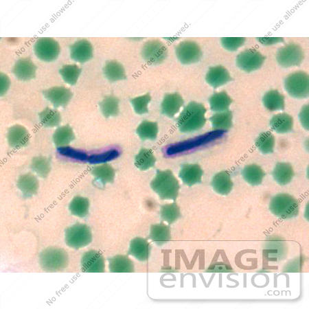 #5038 Stock Photography of Anthrax M by JVPD