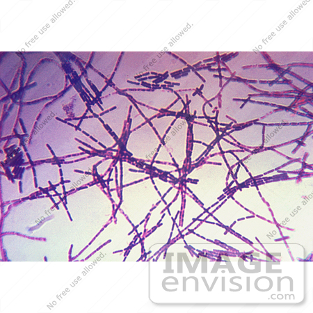 #5041 Stock Photography of Anthrax Bacteria Displayed During a Gram Stain Technique by JVPD
