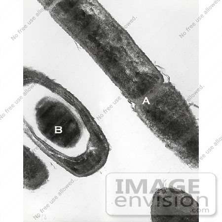 #5042 Stock Photography of an Anthrax Transmission Electron Micrograph by JVPD