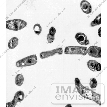 #5044 Bacillus anthracis (Anthrax) Micrograph by JVPD