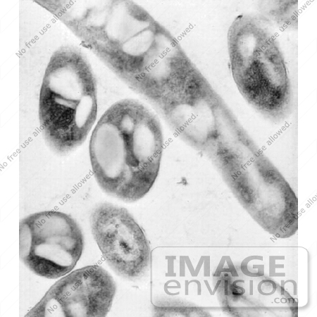 #5047 Anthrax Micrograph by JVPD